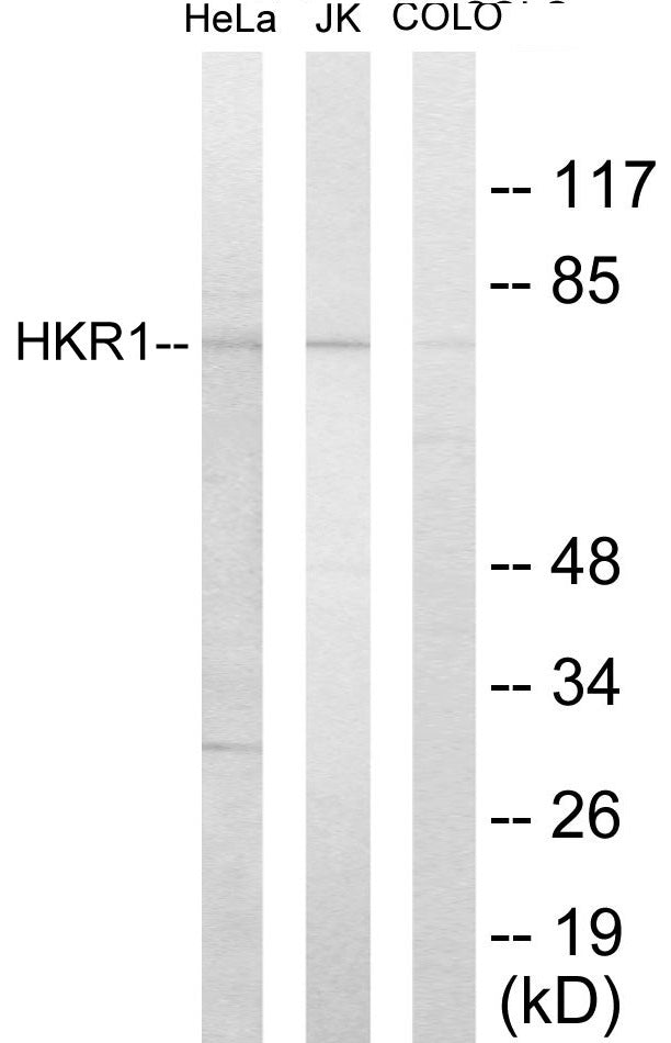 Western blot analysis of extracts from HeLa/Jurkat/COLO205 cells, using HKR1 Antibody.