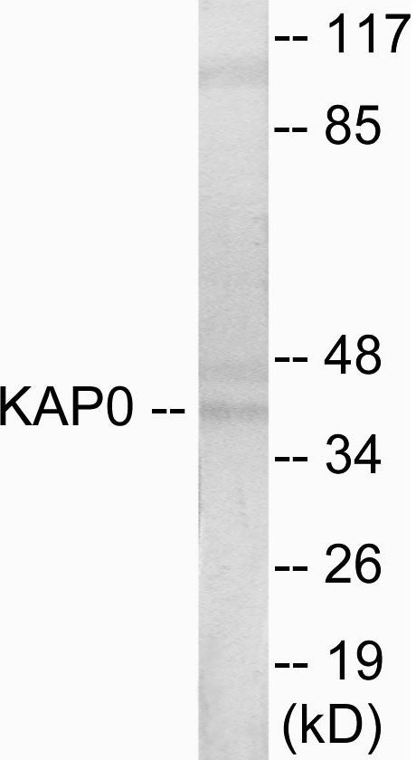 Western blot analysis of extracts from HepG2 cells, using KAP0 Antibody. The lane on the right is treated with the synthesized peptide.