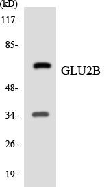 Western blot analysis of extracts from HepG2/293/HuvEC cells, using GLU2B Antibody.