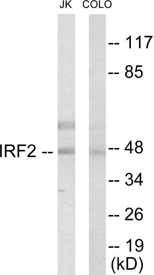 Western blot analysis of extracts from Jurkat/COLO205 cells, using IRF2 Antibody.