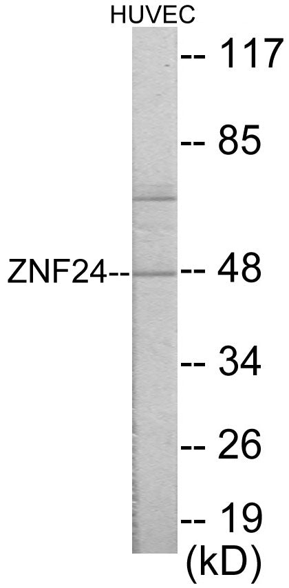 Western blot analysis of extracts from HuvEc cells, using ZNF24 Antibody. The lane on the right is treated with the synthesized peptide.