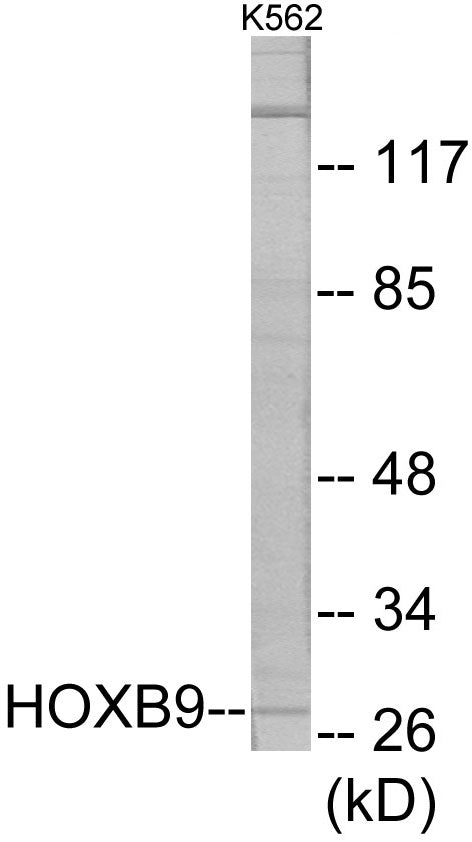 Western blot analysis of extracts from K562 cells, using HOXB9 Antibody. The lane on the right is treated with the synthesized peptide.