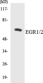 Western blot analysis of extracts from HeLa/Jurkat cells, using EGR1/2 Antibody. The lane on the right is treated with the synthesized peptide.