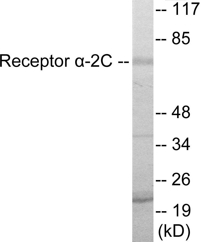 Western blot analysis of extracts from HepG2 cells, using Adrenergic Receptor alpha-2C Antibody. The lane on the right is treated with the synthesized peptide.