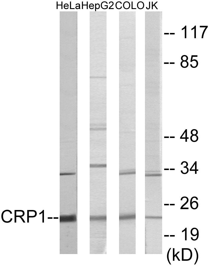 Western blot analysis of extracts from HeLa/HepG2/COLO/Jurkat cells, using CRP1 Antibody.