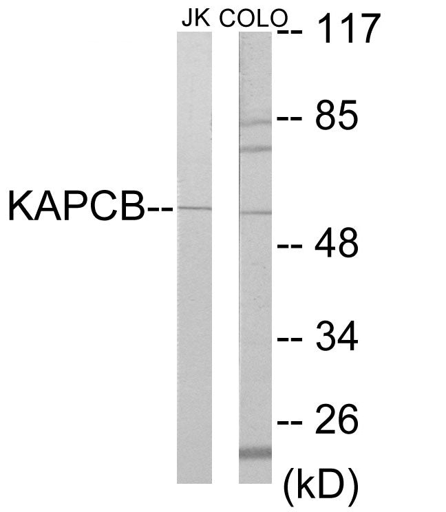 Western blot analysis of extracts from Jurkat/COLO205 cells, using KAPCB Antibody. The lane on the right is treated with the synthesized peptide.