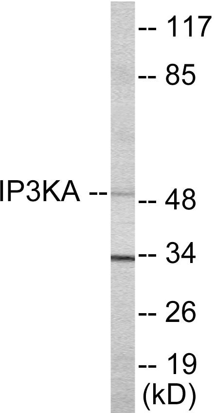 Western blot analysis of extracts from HuvEc cells, using IP3KA Antibody. The lane on the right is treated with the synthesized peptide.