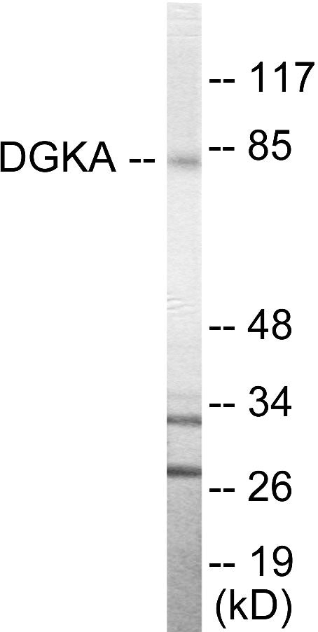 Western blot analysis of extracts from Jurkat cells, using DGKA Antibody. The lane on the right is treated with the synthesized peptide.