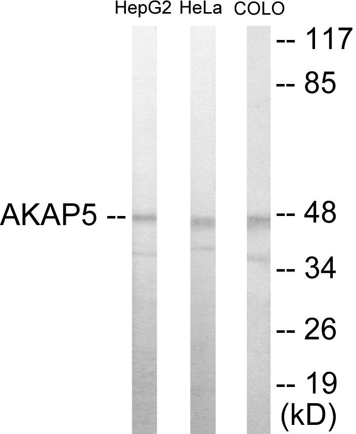 Western blot analysis of extracts from HepG2/HeLa/COLO205 cells, using AKAP5 Antibody.