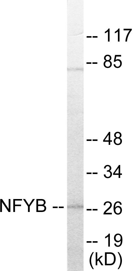 Western blot analysis of extracts from 293 cells, using NFYB Antibody. The lane on the right is treated with the synthesized peptide.