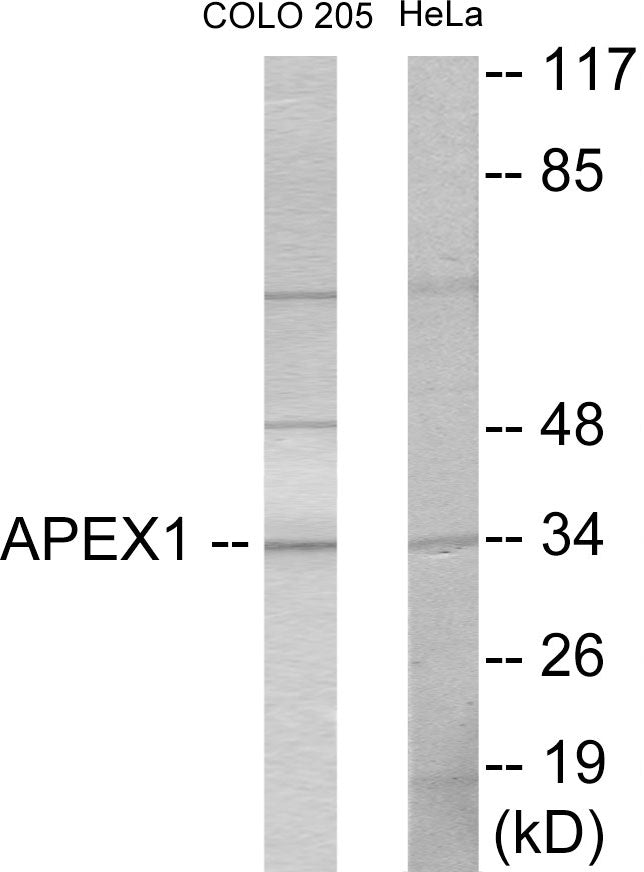 Western blot analysis of extracts from COLO205/HeLa cells, using APEX1 Antibody. The lane on the right is treated with the synthesized peptide.