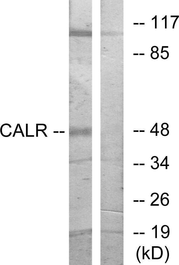Western blot analysis of extracts from COS7 cells, using CALR Antibody.