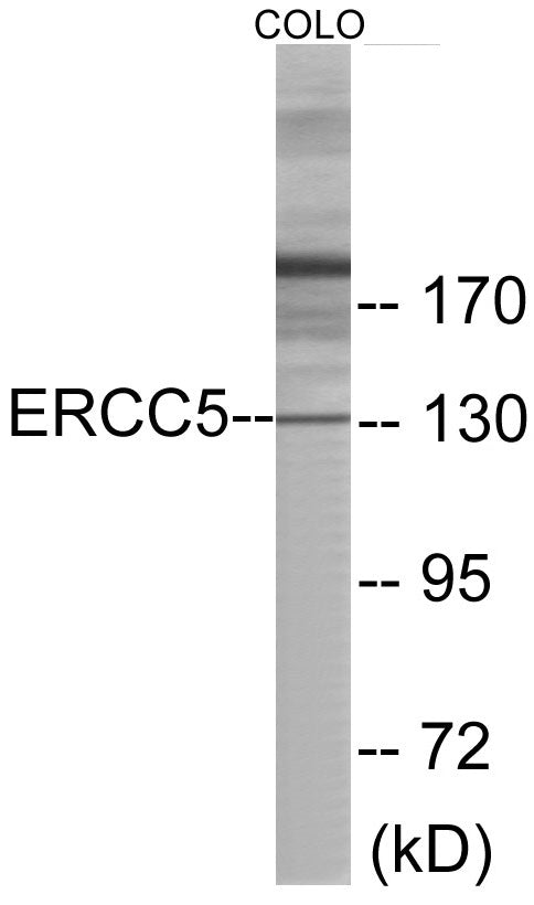 Western blot analysis of extracts from COLO cells, using ERCC5 Antibody.