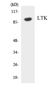 Western blot analysis of extracts from Jurkat cells, using LTK Antibody. The lane on the right is treated with the synthesized peptide.