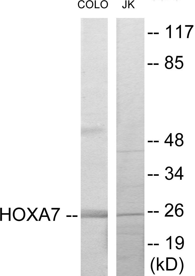 Western blot analysis of extracts from COLO205/Jurkat cells, using HOXA7 Antibody. The lane on the right is treated with the synthesized peptide.