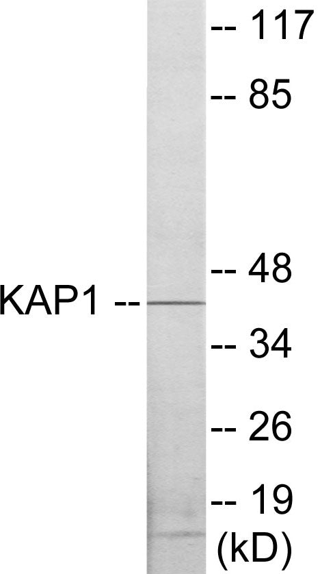 Western blot analysis of extracts from COLO205 cells, using KAP1 Antibody. The lane on the right is treated with the synthesized peptide.