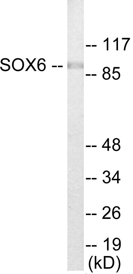 Western blot analysis of extracts from Jurkat cells, using SOX6 Antibody. The lane on the right is treated with the synthesized peptide.