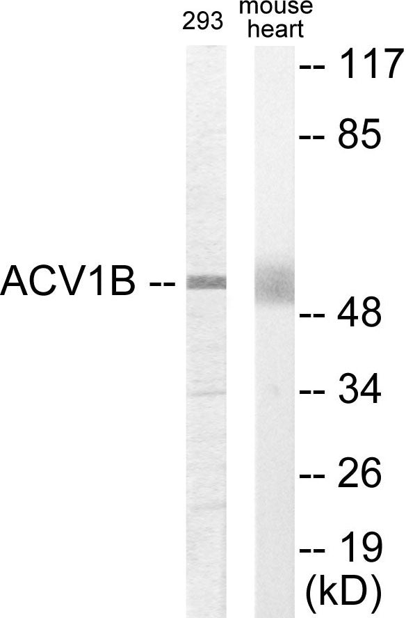 Western blot analysis of extracts from 293/mouse liver cells, using ACV1B Antibody.