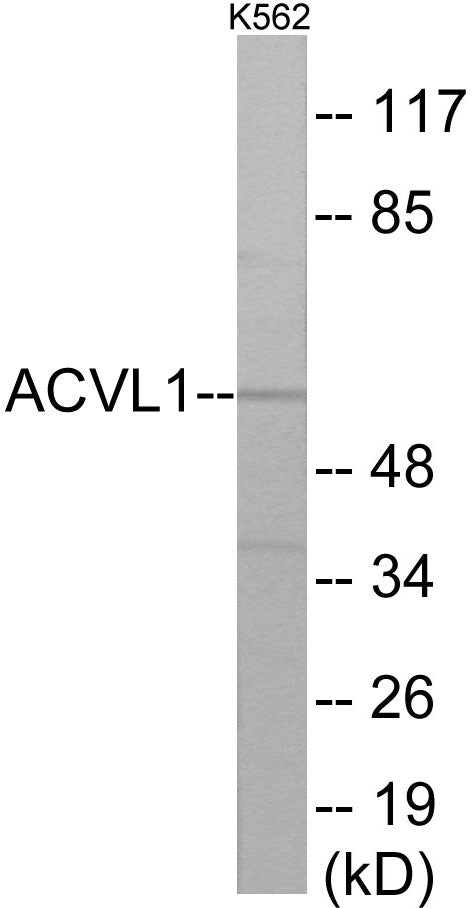 Western blot analysis of extracts from K562 cells, using ACVL1 Antibody.