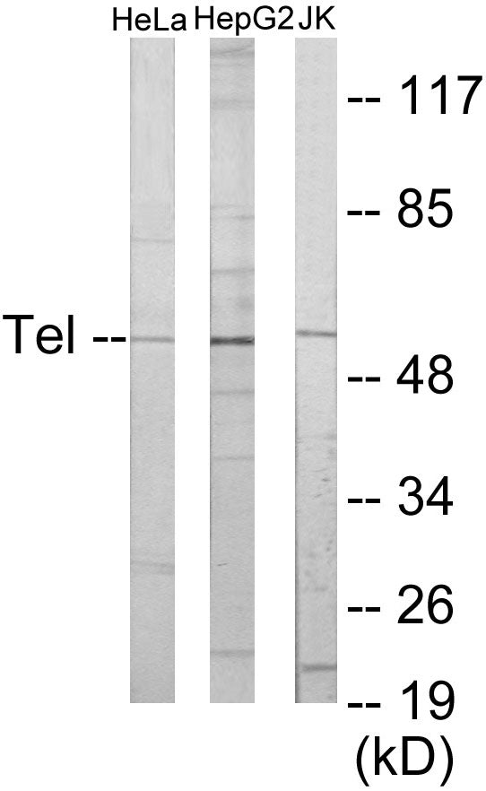 Western blot analysis of extracts from HeLa/HepG2/Jurkat cells, using ETV6 Antibody.