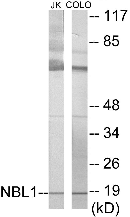 Western blot analysis of extracts from Jurkat/COLO cells, using NBL1 Antibody.