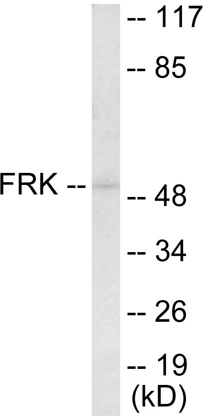 Western blot analysis of extracts from Jurkat cells, using FRK Antibody.