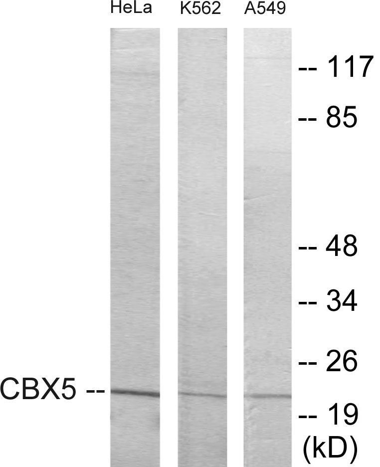 Western blot analysis of extracts from HeLa/A549/K562 cells, using CBX5 Antibody. The lane on the right is treated with the synthesized peptide.