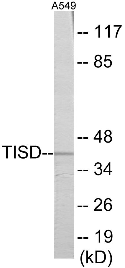 Western blot analysis of extracts from A549 cells, using TISD Antibody. The lane on the right is treated with the synthesized peptide.
