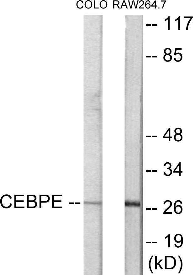 Western blot analysis of extracts from LOVO/RAW264.7 cells, using CEBPD/E Antibody. The lane on the right is treated with the synthesized peptide.