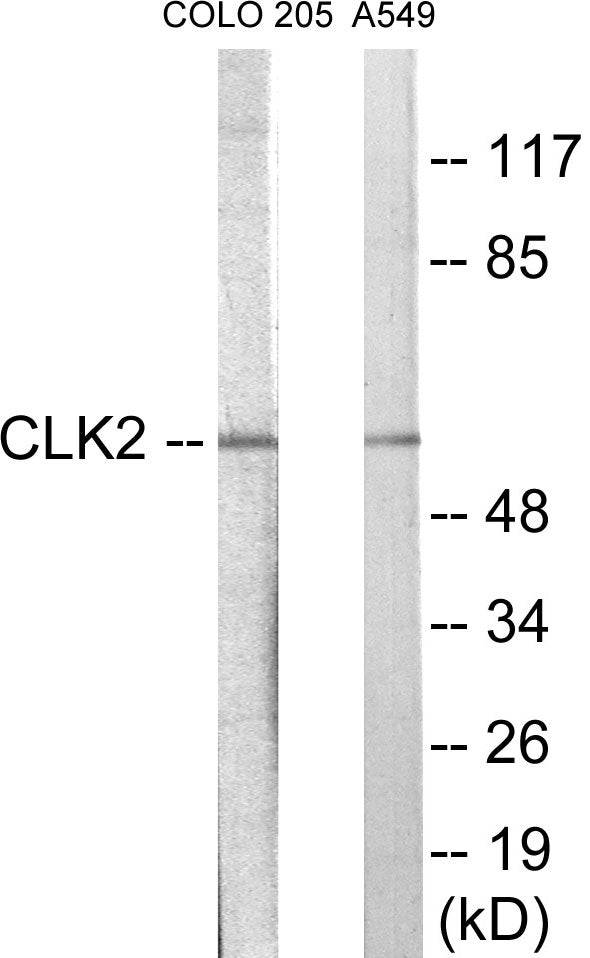 Western blot analysis of extracts from COLO205/A549 cells, using CLK2 Antibody. The lane on the right is treated with the synthesized peptide.