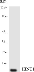 Western blot analysis of extracts from Jurkat cells, using HINT1 Antibody.