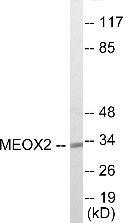 Western blot analysis of extracts from COLO205 cells, using MEOX2 Antibody. The lane on the right is treated with the synthesized peptide.