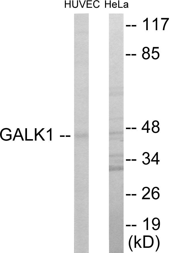 Western blot analysis of extracts from HuvEc/HeLa cells, using GALK1 Antibody. The lane on the right is treated with the synthesized peptide.