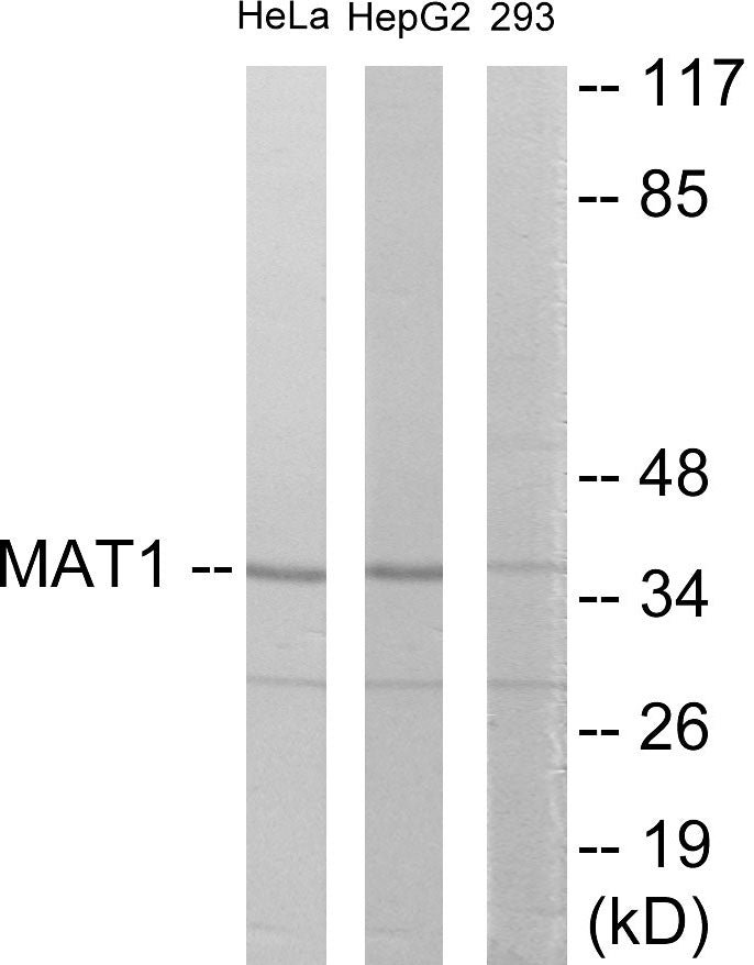 Western blot analysis of extracts from HeLa/HepG2/293 cells, using MAT1 Antibody. The lane on the right is treated with the synthesized peptide.