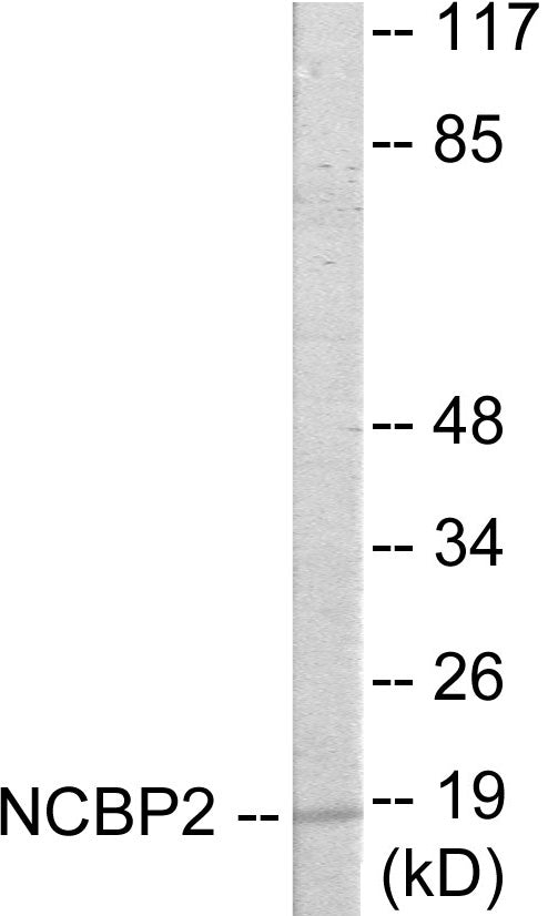 Western blot analysis of extracts from COLO205 cells, using NCBP2 Antibody. The lane on the right is treated with the synthesized peptide.