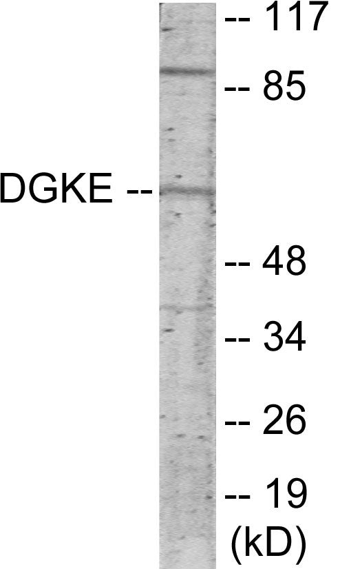 Western blot analysis of extracts from K562 cells, using DGKE Antibody. The lane on the right is treated with the synthesized peptide.