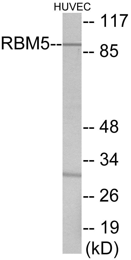 Western blot analysis of extracts from HuvEc cells, using RBM5 Antibody.