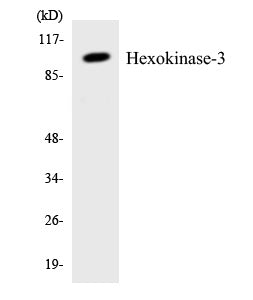 Western blot analysis of extracts from Jurkat cells, treated with insulin 0.01U/ml 15', using Hexokinase-3 Antibody. The lane on the right is treated with the synthesized peptide.