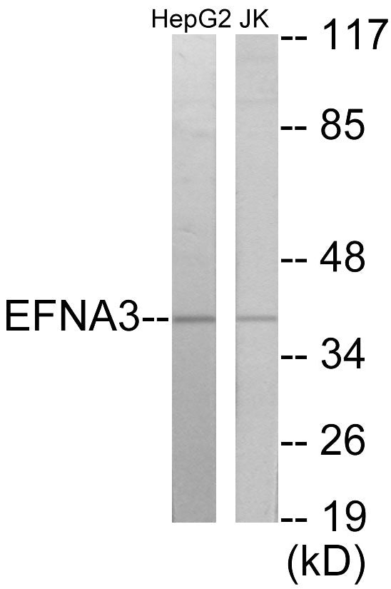 Western blot analysis of extracts from HepG2/Jurkat cells, using EFNA3 Antibody. The lane on the right is treated with the synthesized peptide.
