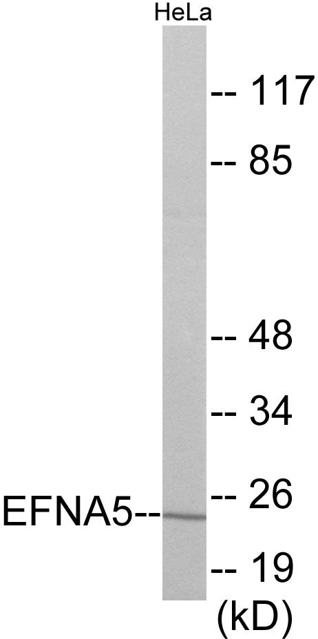 Western blot analysis of extracts from HeLa cells, using EFNA5 Antibody.