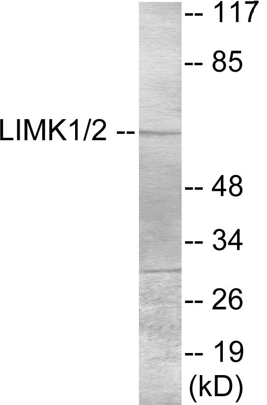Western blot analysis of extracts from NIH-3T3 cells, treated with UV, using LIMK1 Antibody. The lane on the right is treated with the synthesized peptide.