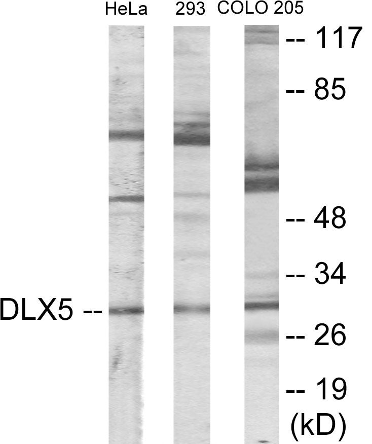 Western blot analysis of extracts from HeLa/293/COLO205 cells, using DLX5 Antibody.