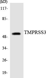 Western blot analysis of extracts from HuvEc cells, using TMPRSS3 Antibody.