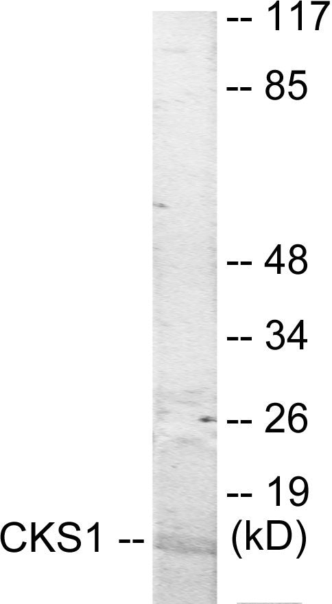 Western blot analysis of extracts from Jurkat cells, treated with serum 20% 15’, using CKS1 Antibody.