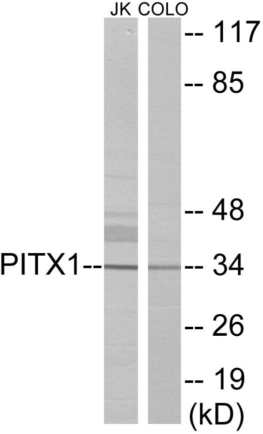 Western blot analysis of extracts from Jurkat/COLO cells, using PITX1 Antibody. The lane on the right is treated with the synthesized peptide.