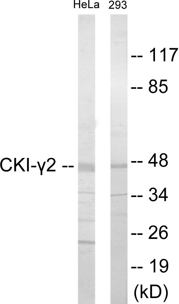 Western blot analysis of extracts from HeLa/293 cells, using CKI-gamma2 Antibody. The lane on the right is treated with the synthesized peptide.