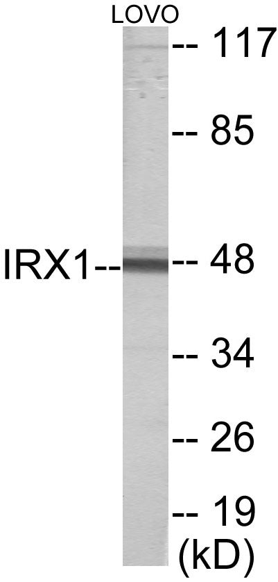 Western blot analysis of extracts from LOVO cells, using IRX1 Antibody. The lane on the right is treated with the synthesized peptide.
