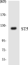Western blot analysis of extracts from COLO205 cells, using ST5 Antibody. The lane on the right is treated with the synthesized peptide.