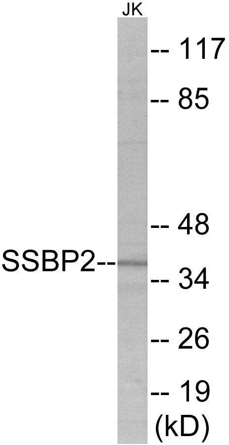 Western blot analysis of extracts from Jurkat cells, using SSBP2 Antibody.