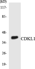 Western blot analysis of extracts from COLO205 cells, using CDKL1 Antibody. The lane on the right is treated with the synthesized peptide.